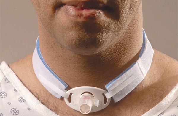 Tracheostomiekanülen-Fixation mit Nackenband