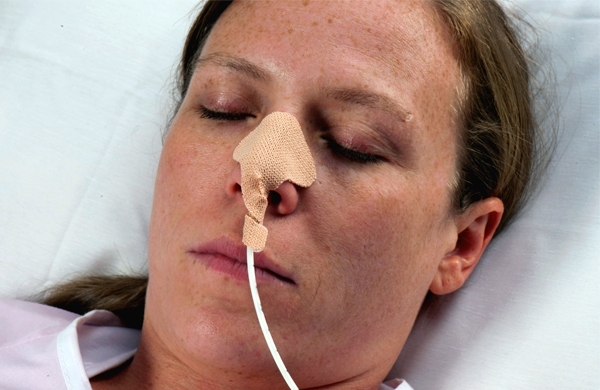 Patientin im Pflegebett mit naso-gastralem Sondenhalter