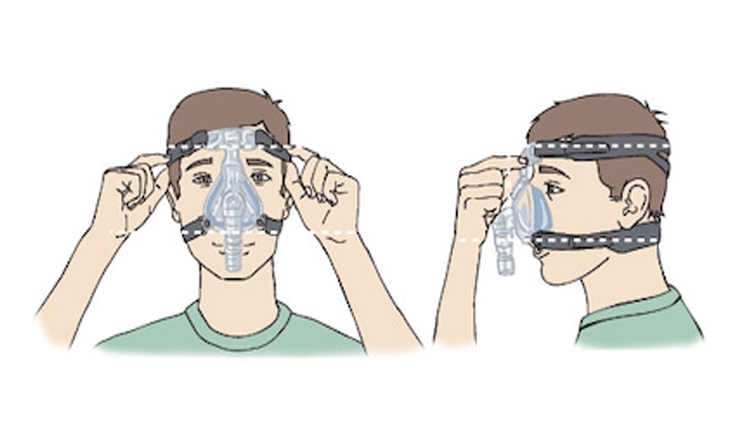 Graphik: Anpassung der Maske